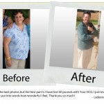 ba14 your-hcg-before-after_ladeana